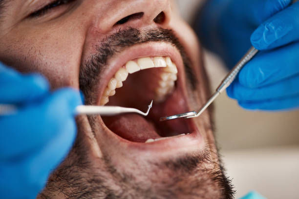 Best Emergency Care for Gum Disease in Montgomery, IL