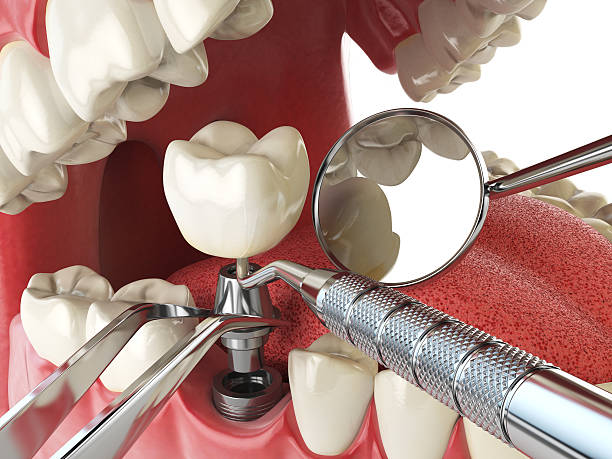 Best 24-Hour Emergency Dental Care in Montgomery, IL